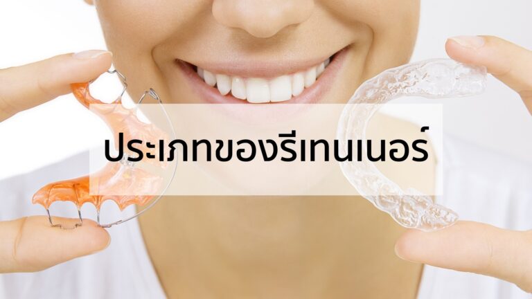 รู้จักประเภทของรีเทนเนอร์