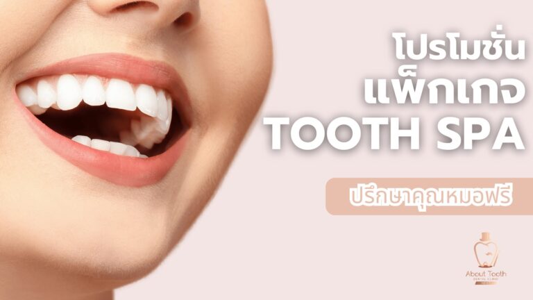 Tooth spa package promotion