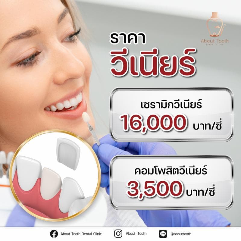 การทำวีเนียร์ มีราคาโดยประมาณการเท่าไร ?