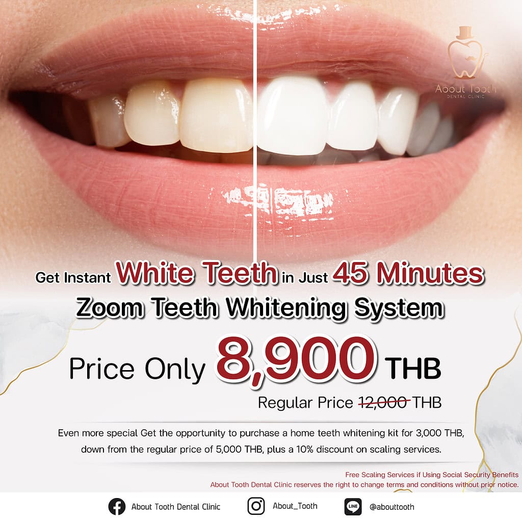 Zoom! Teeth Whitening